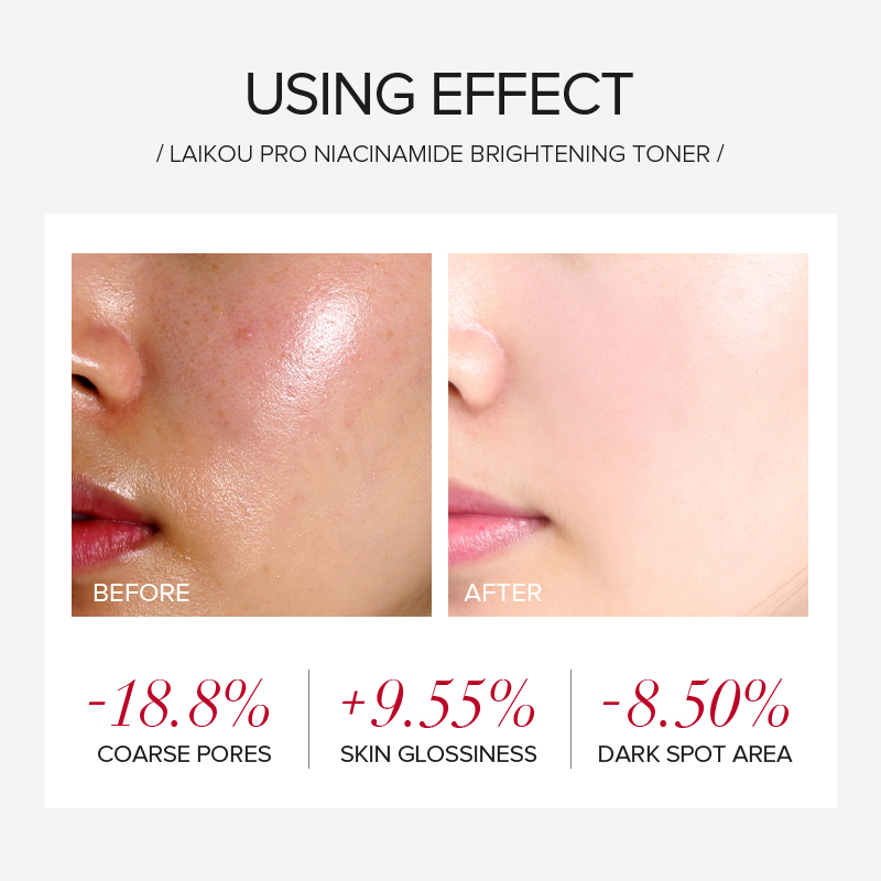 LAIKOU PRO Niacinamide 4Pcs Br - Skincare Niacinamide ulasan dan harga