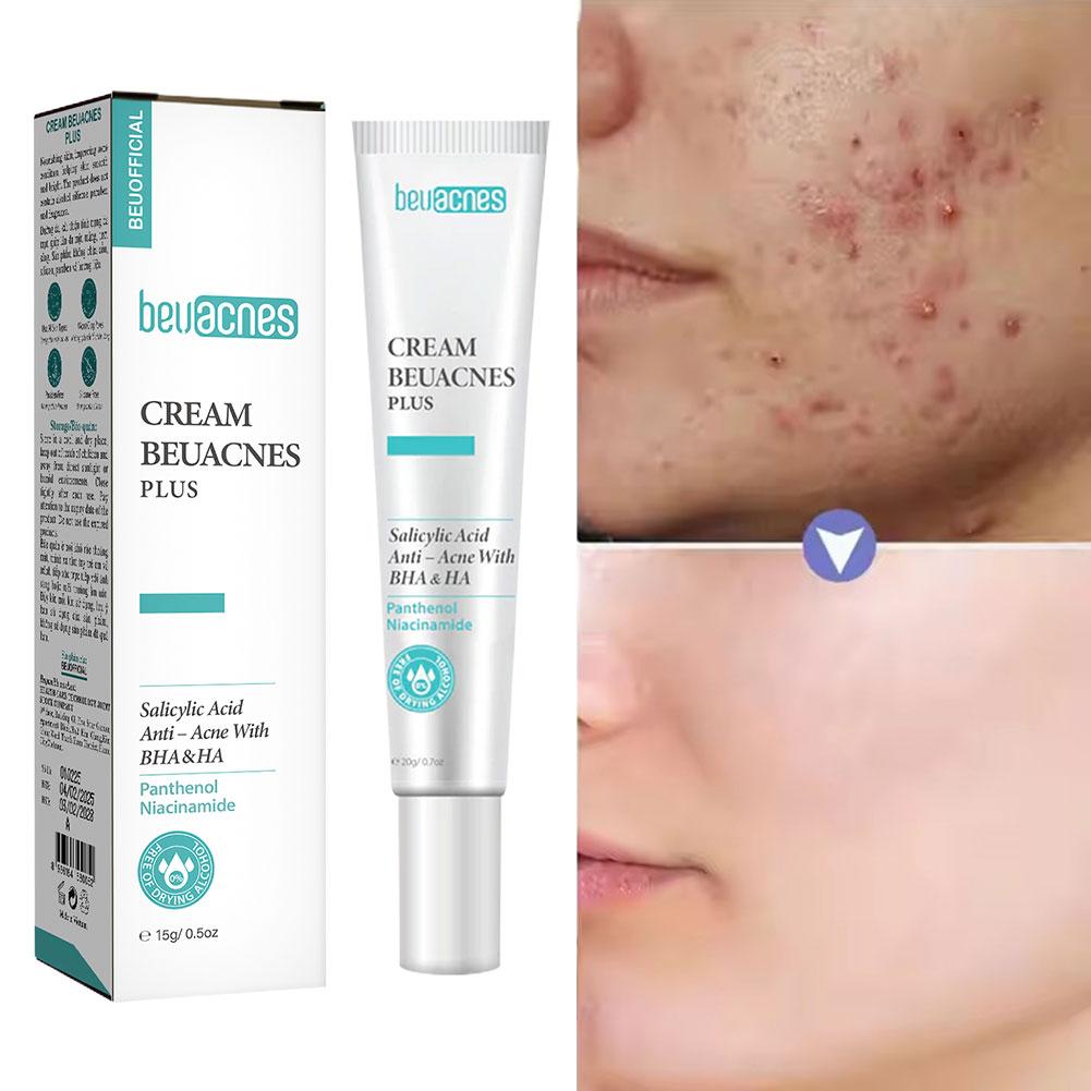 New 20g Niacinamide Acne Gel A - Skincare Niacinamide ulasan dan harga