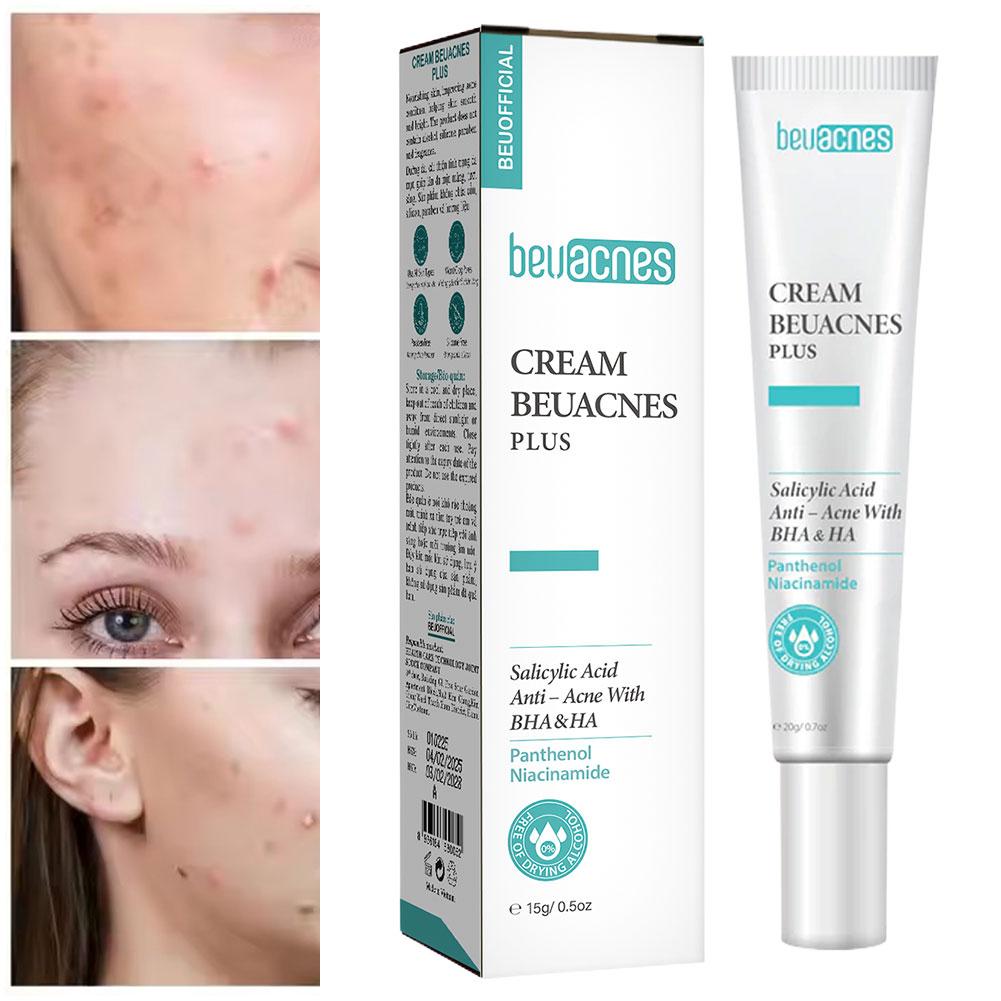 New 20g Niacinamide Acne Gel A - Skincare Niacinamide ulasan dan harga