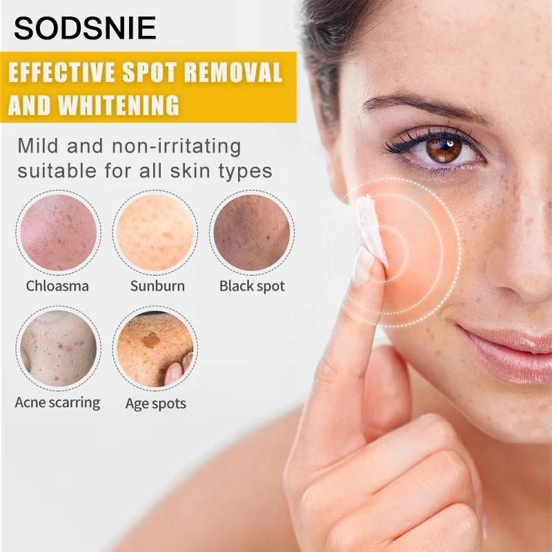 Dark Spot Remover Vitamin C Wh - Skincare Niacinamide ulasan dan harga