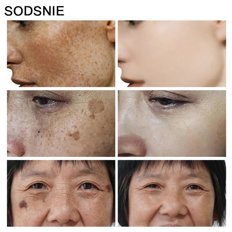 Dark Spot Remover Vitamin C Wh - Skincare Niacinamide ulasan dan harga
