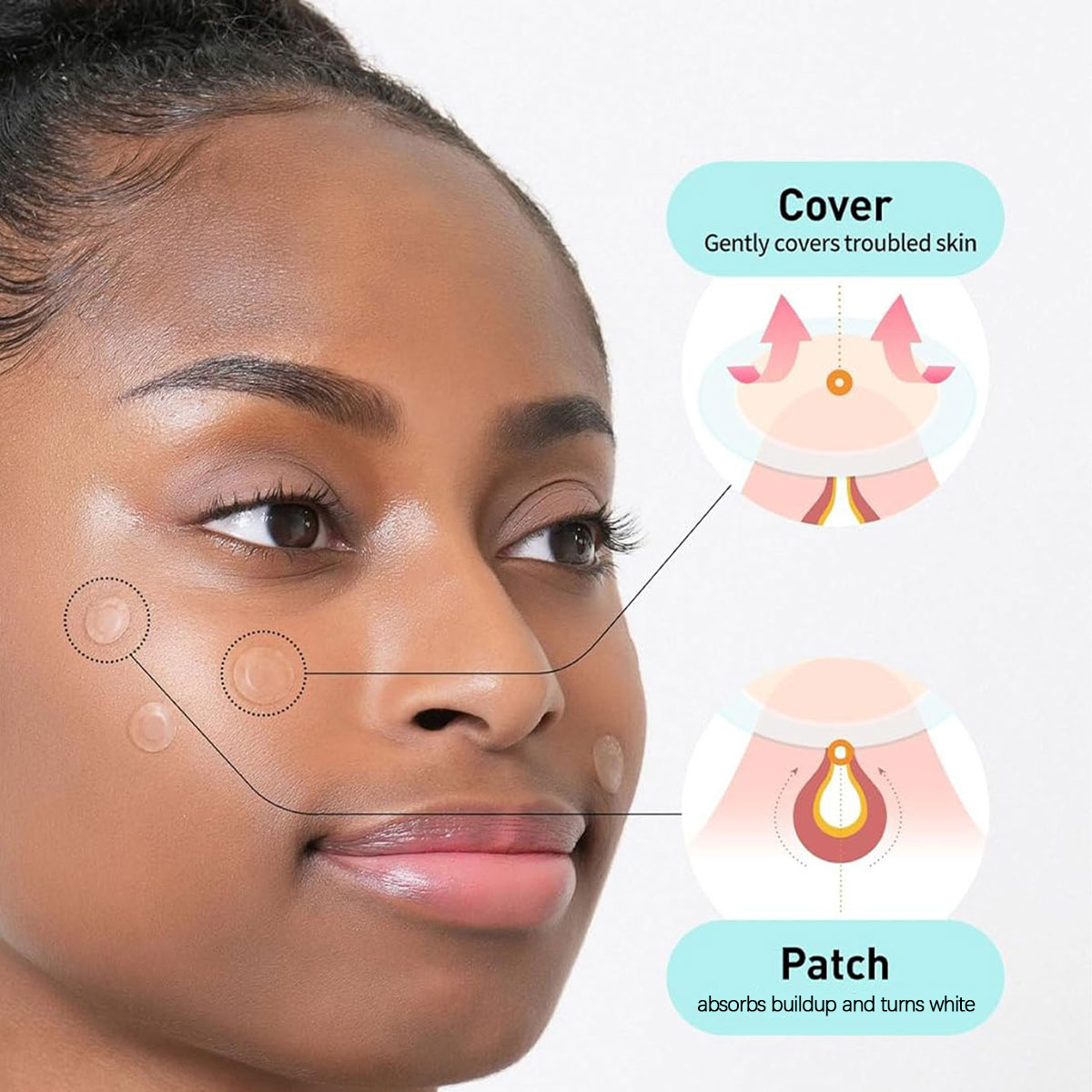 Olive Young Care Plus Spot Cov - Skincare Acne ulasan dan harga